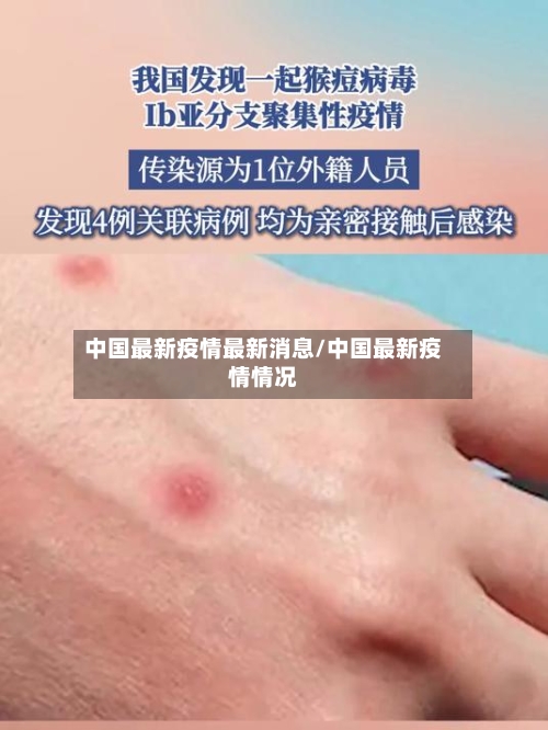中国最新疫情最新消息/中国最新疫情情况-第3张图片