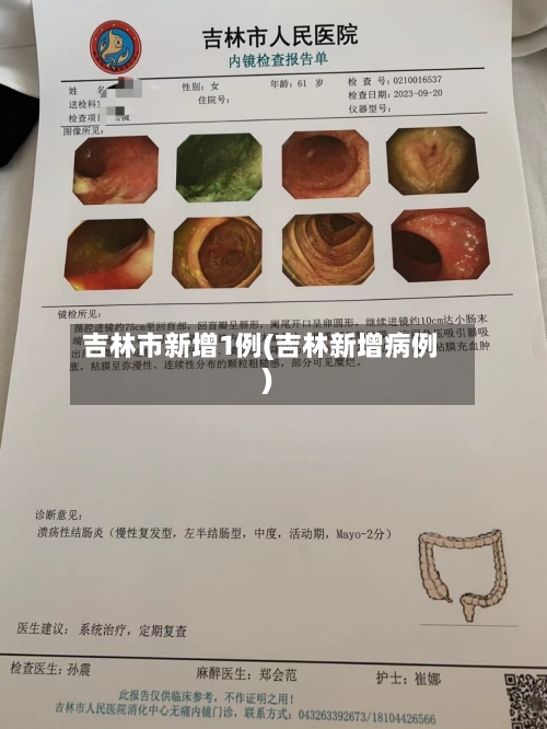 吉林市新增1例(吉林新增病例)-第2张图片